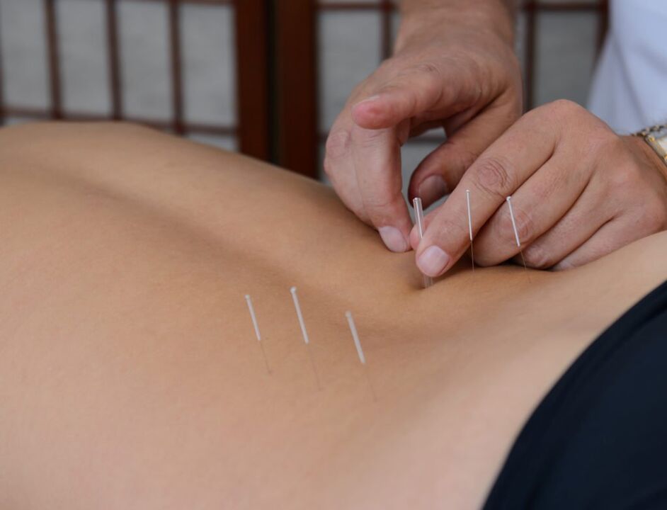 akupunktúra pre prostatitídu