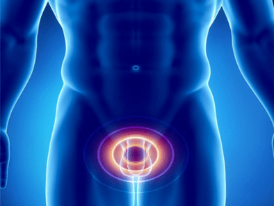 Prostatitída – zápal prostaty u muža